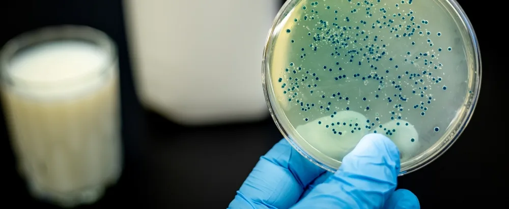 A pasteurização ajudou a diminuir as infeções microbianas